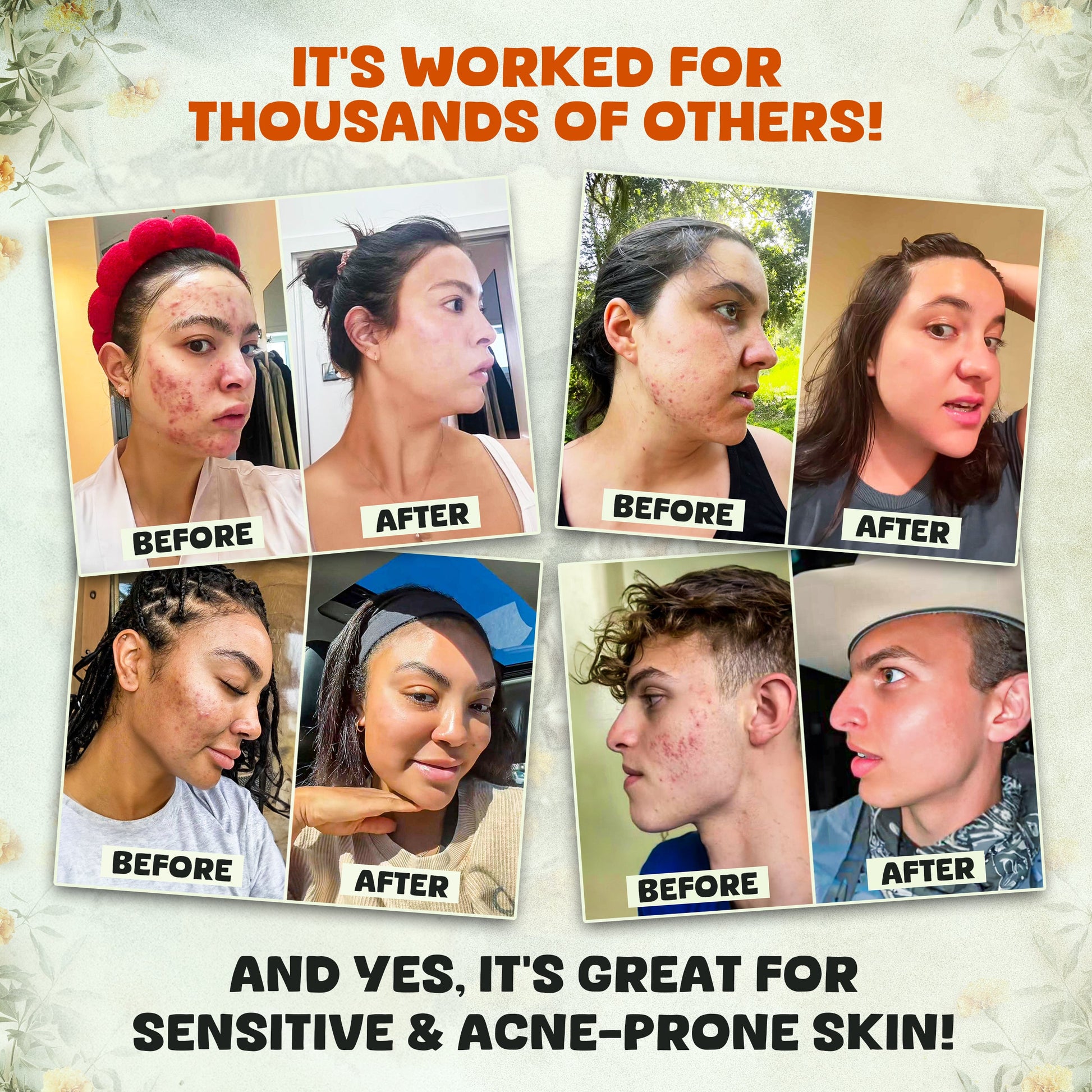 Bálsamo de sebo todo en uno: suaviza las arrugas, combate el acné y mantiene la piel suave todo el día.