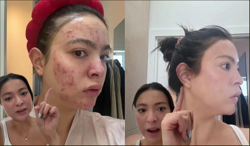 Bálsamo de miel y sebo batido